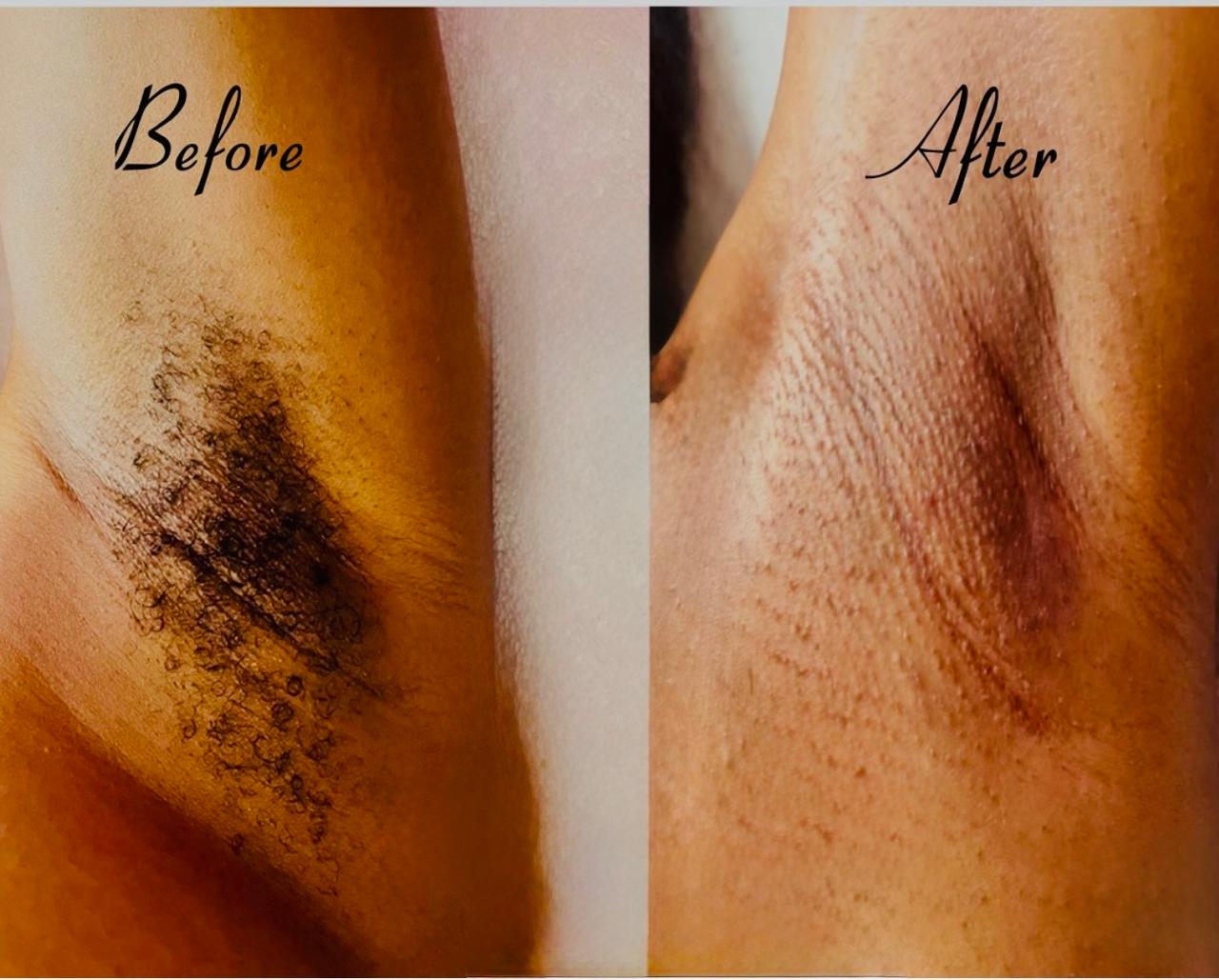 Waxing Services at Dazzling Angels Day Spa